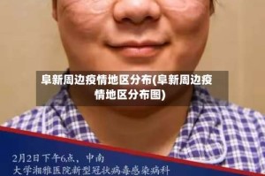 阜新周边疫情地区分布(阜新周边疫情地区分布图)