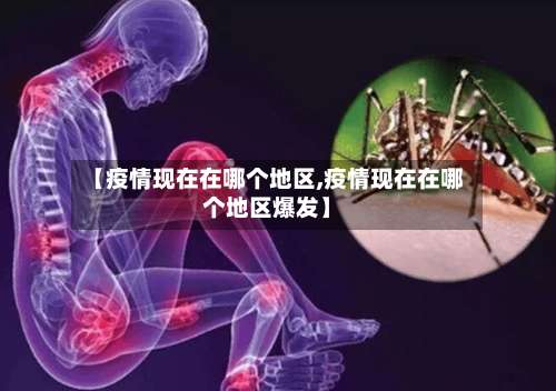 【疫情现在在哪个地区,疫情现在在哪个地区爆发】-第2张图片